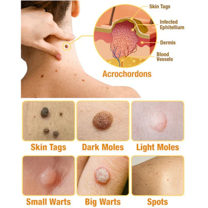 Bee Venom Treatment Spray for Skin Repair | Natural Healing Formula for Soothing Irritation