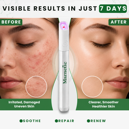 SkinRenew – All-in-One CO₂ Laser Eraser Pen