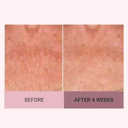 Moisturizing Body Cream, Body Firming Cream for Belly and Thighs – image 5