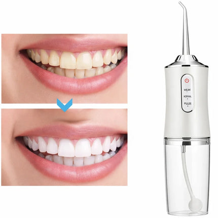 Portable Oral Irrigator, Rechargeable Water Flosser with Soft Mode, Standard and Tongue Scraper Nozzles, Compact Travel Size