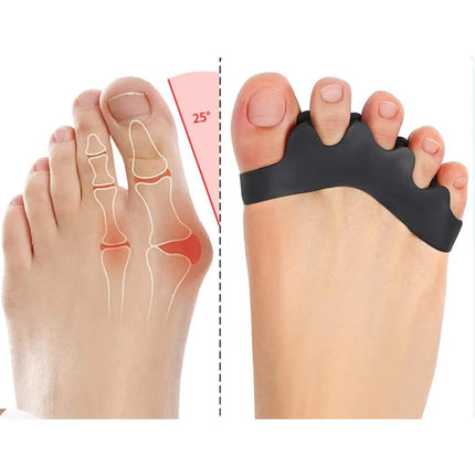 Toe Spacers for Bunions and Overlapping Toes – image 6
