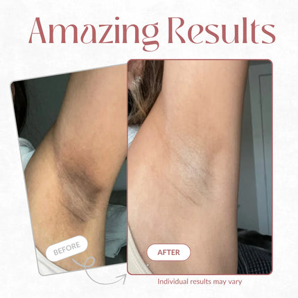 Body Peel Spray with Kojic Acid and Turmeric | Gentle Exfoliating Formula for Smoother Skin 3