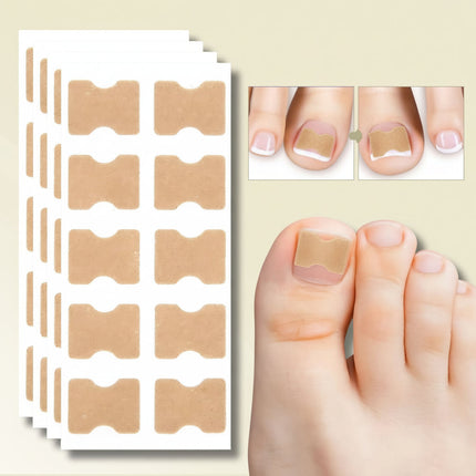 Ingrown Toenail Correction Patches for Healthy Nail Growth | Comfortable Non-Invasive Support for Daily Wear