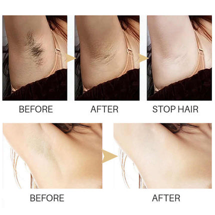 Hair Removal Serum, Plant Based Hair Growth Inhibitor Serum – image 10