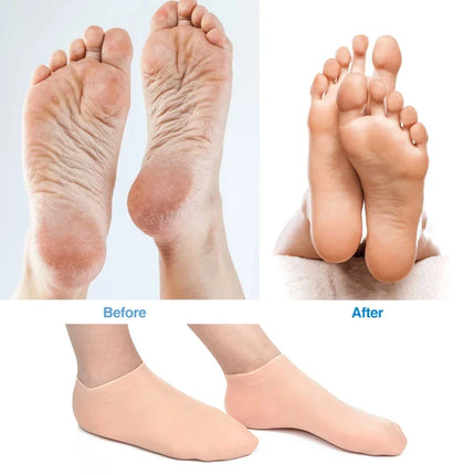 Non Slip Silicone Socks with Quick Dry Barefoot Fit – image 7