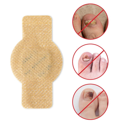Fungal Nail Patches for Toenails and Fingernails – image 6