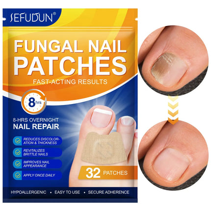 Toenail Fungus Treatment with Tea Tree Oil – image 4