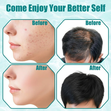 High Frequency Facial Wand with Violet Glass Tubes | Portable Skin Care Device for Clearer Skin