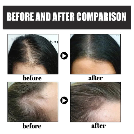 Hair Building Fibres Powder for Thinning Hair, 9 Shades Sweat Resistant Grey Root Touch Up Concealer
