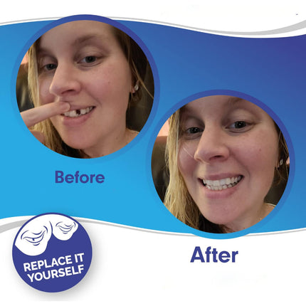 Teeth Veneer Cosmetic Cover Set with Custom Fit | Smile Enhancement for Gaps and Stains