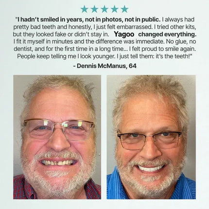 Full Dentures, Full Dentures – image 29