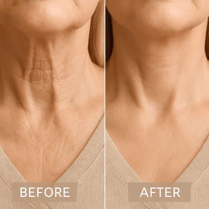 Neck Tape for Turkey Neck Lift