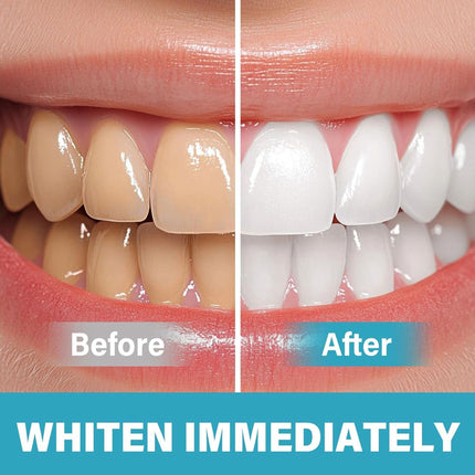 Instant Teeth Whitening Polish for Coffee and Wine Stains – image 7