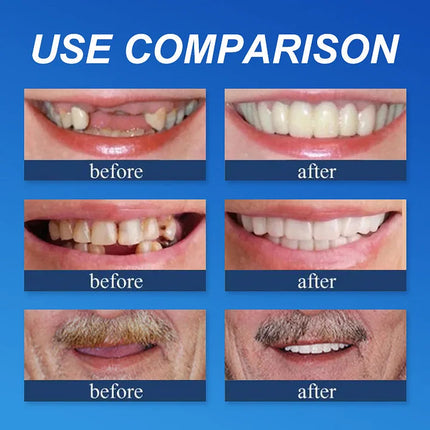 Full Dentures – image 14