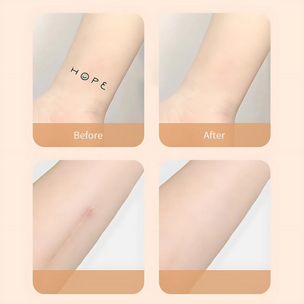 Scar Patches Skin Tone, Sweat Proof Tattoo Concealer for Scars and Skin Imperfections – image 5