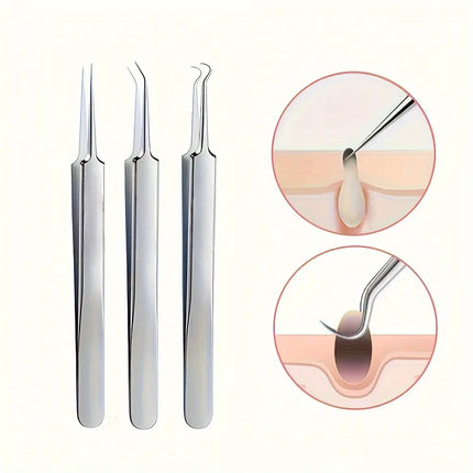 Blackhead Extractor Tool Kit, Stainless Steel Comedone Tweezers Set with Ultra-Fine Tips for At-Home Blemish Removal