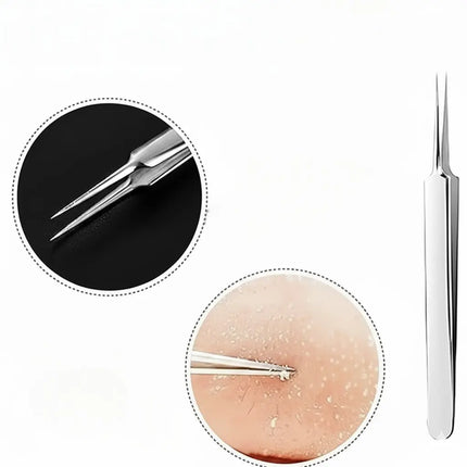 Blackhead Extractor Tool Kit, Stainless Steel Comedone Tweezers Set with Ultra-Fine Tips for At-Home Blemish Removal