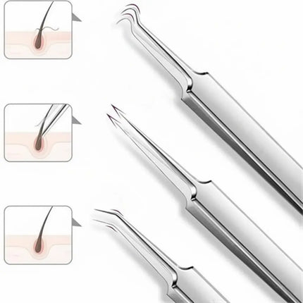 Blackhead Extractor Tool Kit, Stainless Steel Comedone Tweezers Set with Ultra-Fine Tips for At-Home Blemish Removal