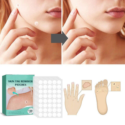 Hydrocolloid Skin Tag Remover Patches for Clear Skin | 120 Adhesive Spot Treatments for Targeted Care