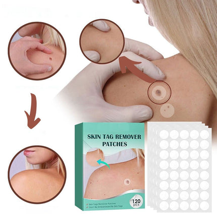 Hydrocolloid Skin Tag Remover Patches for Clear Skin | 120 Adhesive Spot Treatments for Targeted Care