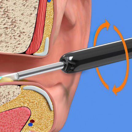 Ear Cleaner with HD Camera | Wireless Design for Safe, Effective Cleaning